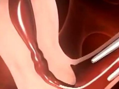 试管婴儿孩子长相遗传：随父还是母？